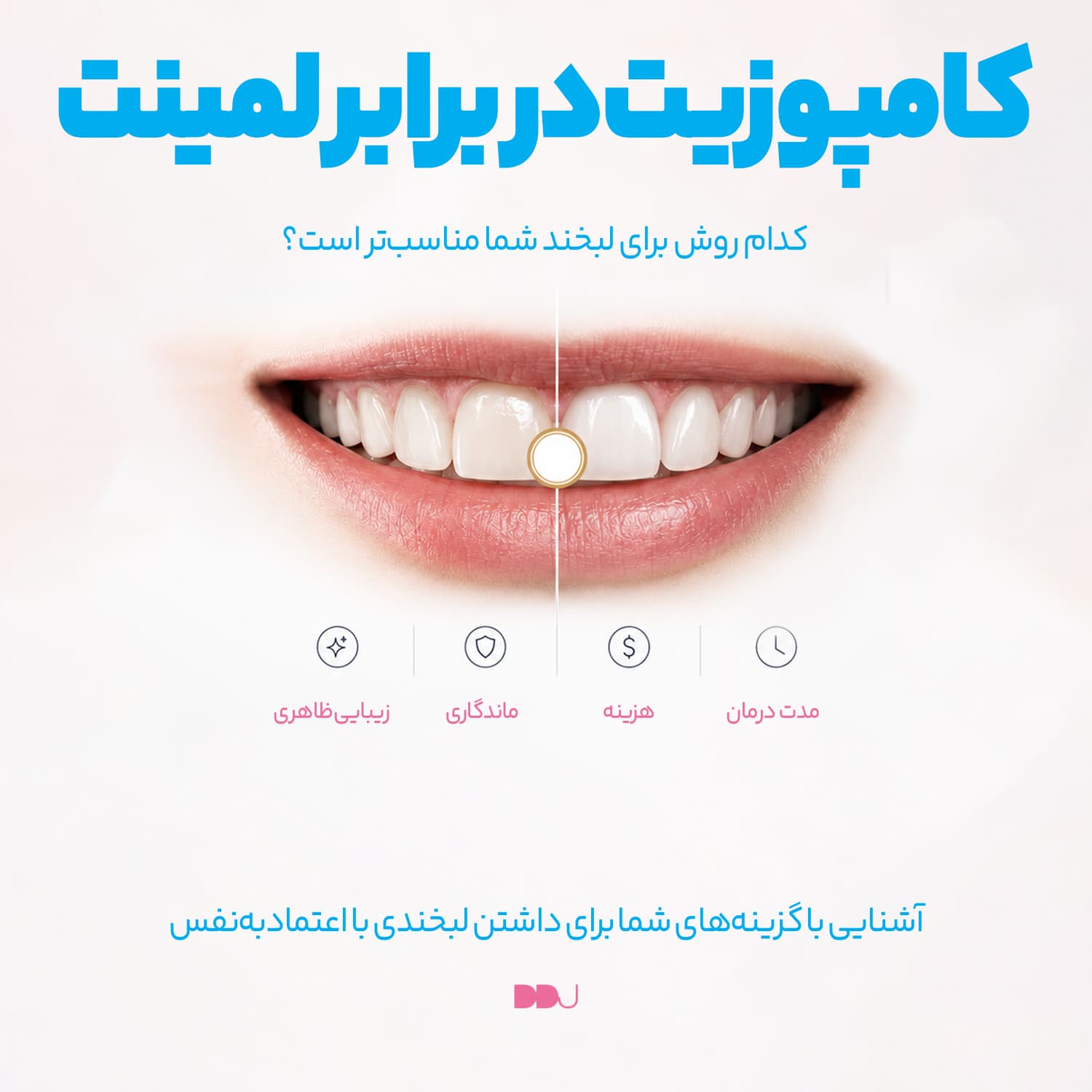 مقایسه کامپوزیت و لمینیت